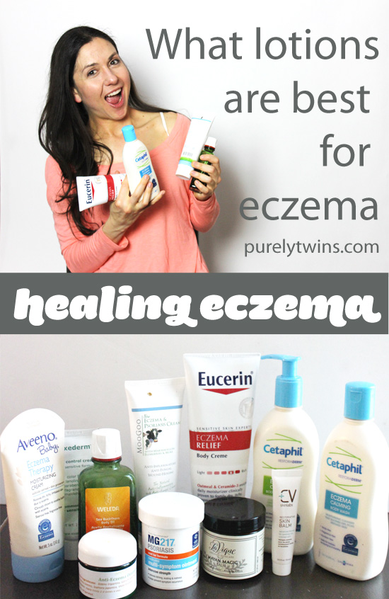 What lotions and products are best to heal eczema. 