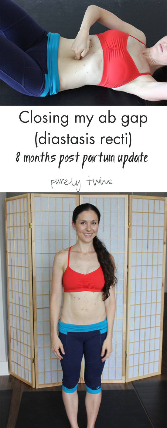 My personal post partum journey to close ab gap through working out smart, breathing correctly, and exercises to strengthen the core. I am at 8 months post partum - giving an update on how my gap is getting smaller. || www.purelytwins.com #postpartum #newmom #diastasis #abseparation #mom