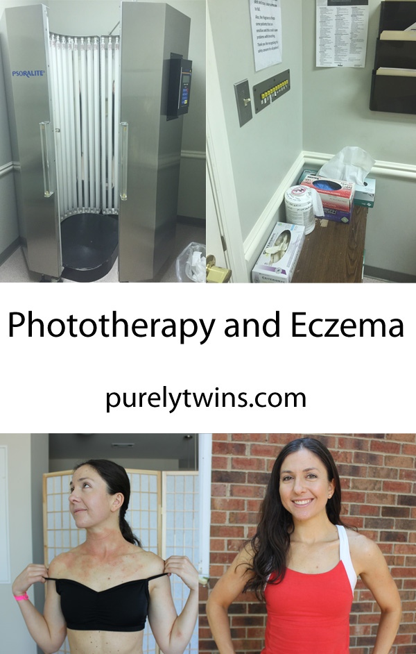 Phototherapy to help heal my eczema. 
