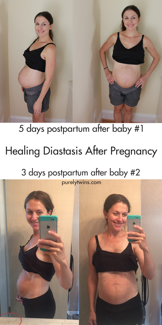 Sharing my diastasis recovery plan and how I did things different after baby #2 to get better results compared to after baby #1. Postpartum belly comparison and how to heal diastasis.