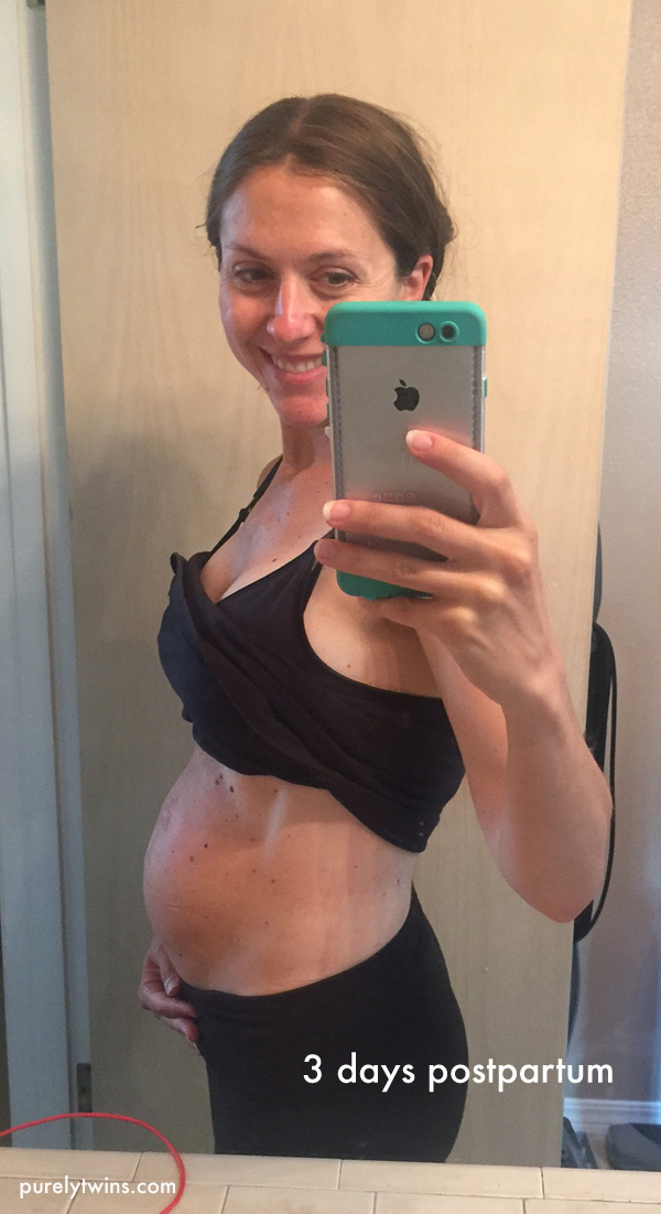 3 days pp after baby 2-progress