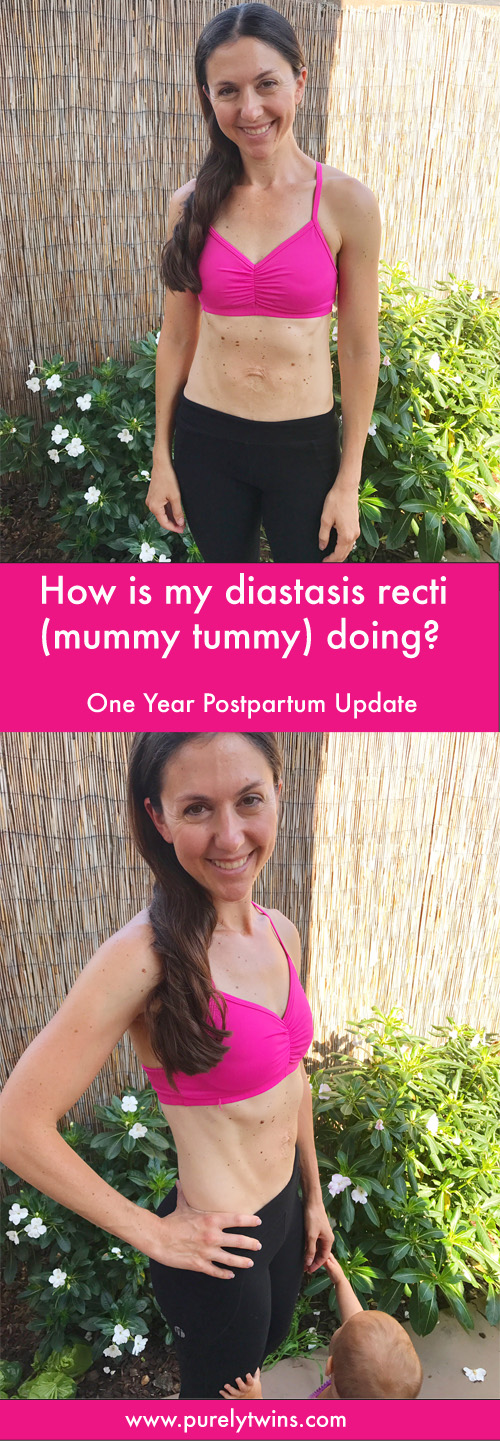 1 year postpartum belly update. How is my diastasis recti (ab separation) doing one year later after second baby? Sharing what I focused on to get flatter tummy and how my core strength is to fix mummy tummy. 