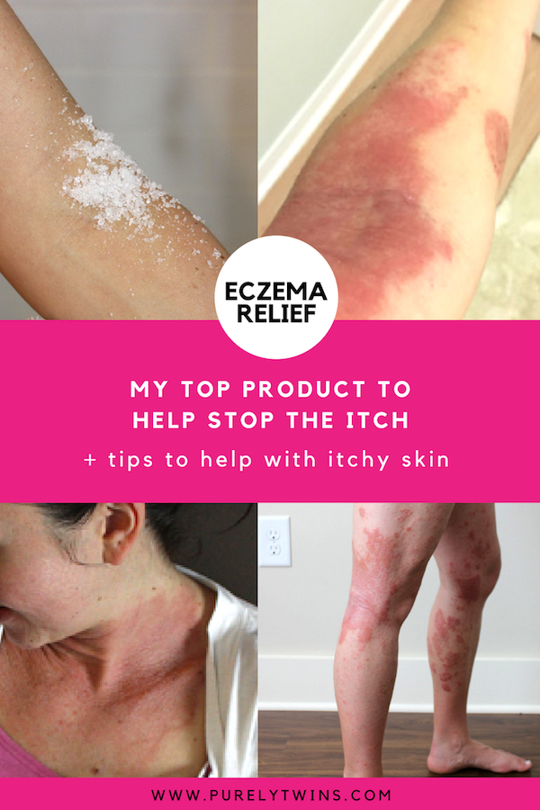 How to stop itchy eczema skin. Sharing my top product and tips to help deal with itchy skin. If you have eczema I hope my tips help you with your healing skin journey. #eczema #skinhealth #healthyskin #itchyskin